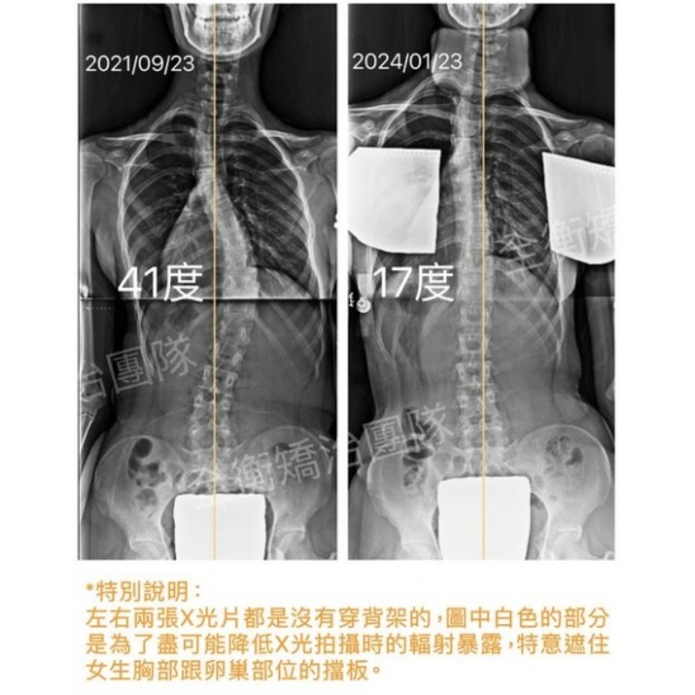 青少年 趨近成熟期