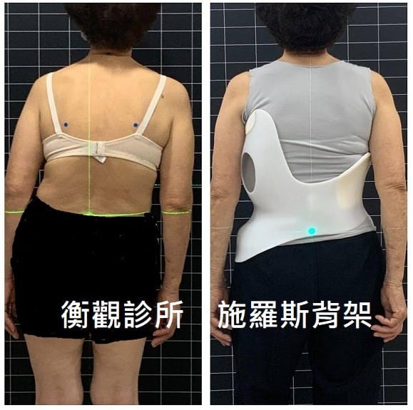 施羅斯側彎背架 老人