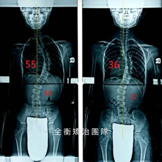 案例6:X光對比 上傳官網.jpg 案例6:X光對比 上傳官網.jpg