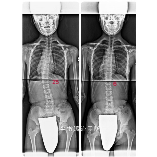 案例9:X光對比 上傳官網.jpg 案例9:X光對比 上傳官網.jpg