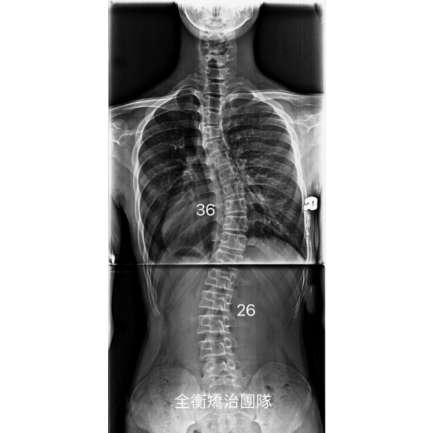 X光.jpg X光.jpg