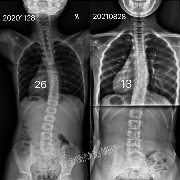X光对比.jpg X光对比.jpg
