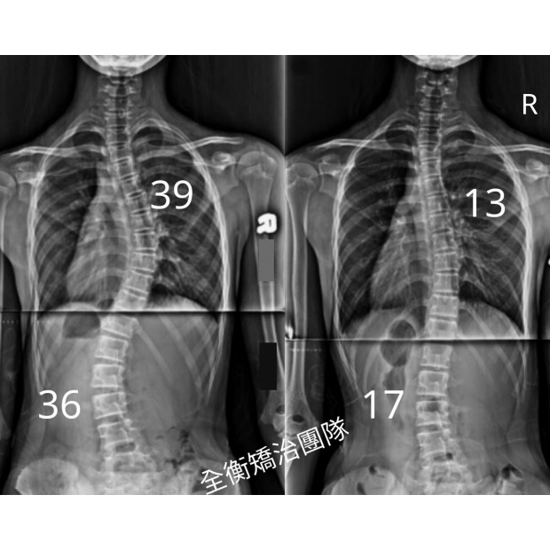X光對比 5607 .jpg X光對比 5607 .jpg