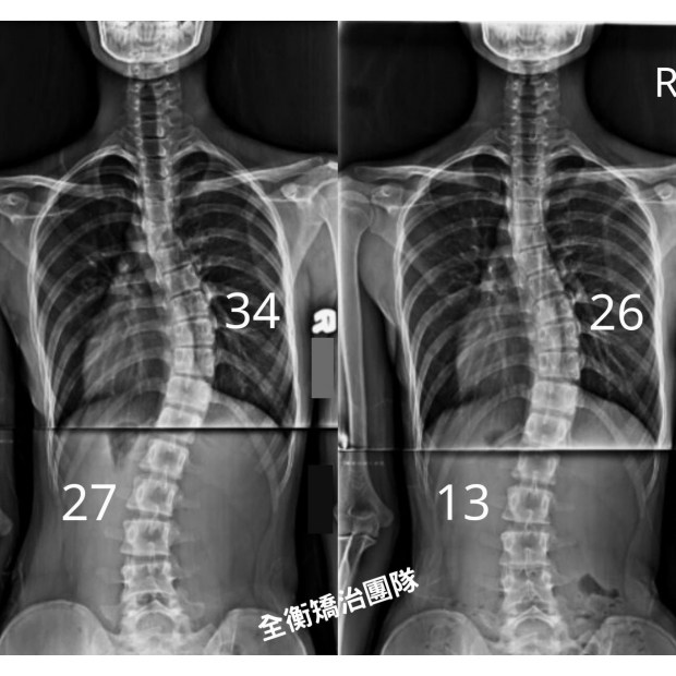 X光對比  _1_.jpg X光對比  _1_.jpg