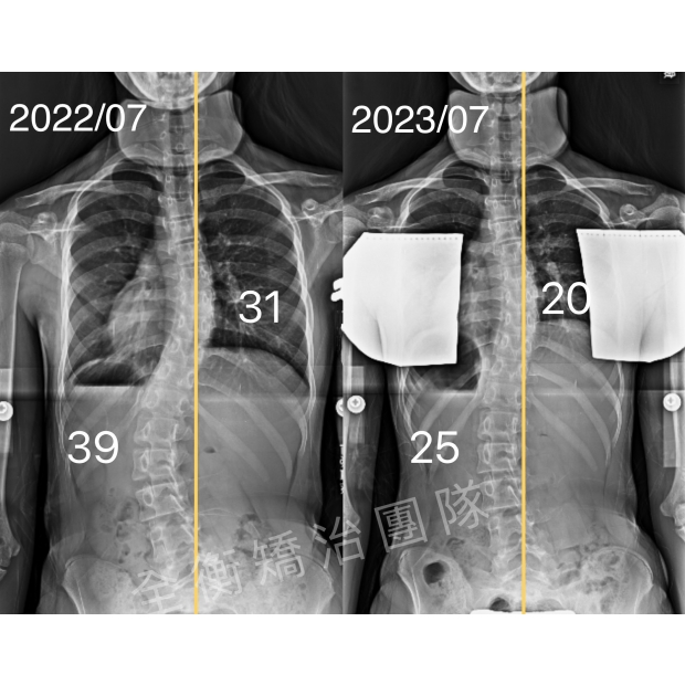 X光對比照.jpg X光對比照.jpg