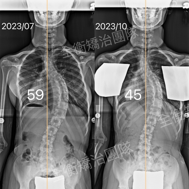 7107 X光對比.jpg 7107 X光對比.jpg