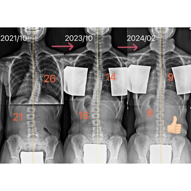 6167 X光對比.jpg 6167 X光對比.jpg