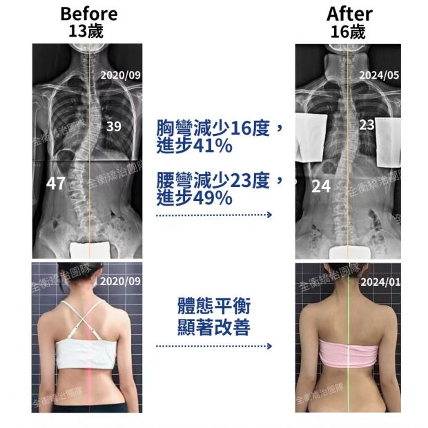 X光對比.jpg X光對比.jpg