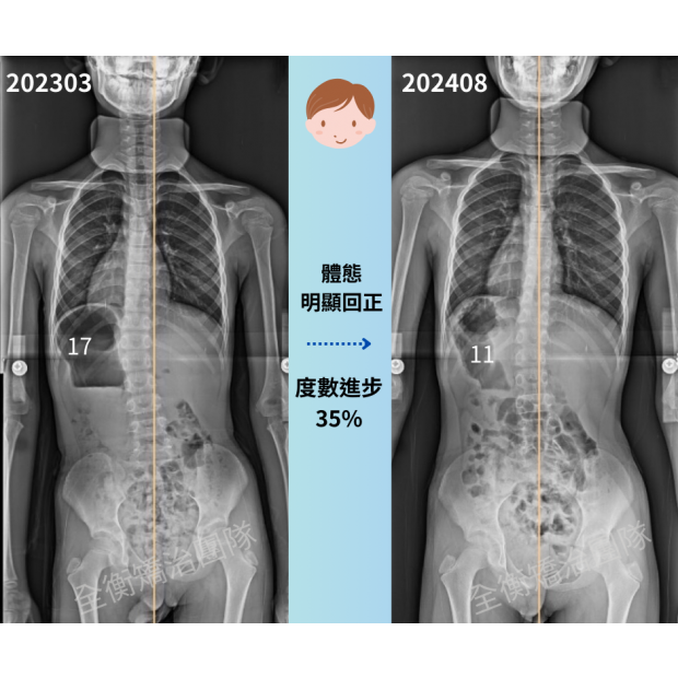 診所案例分享 6925 李鎬宇.png