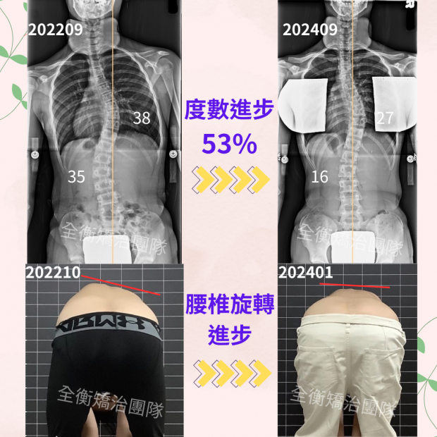 診所案例分享62 - 6627林芷彤.png 診所案例分享62 - 6627林芷彤.png