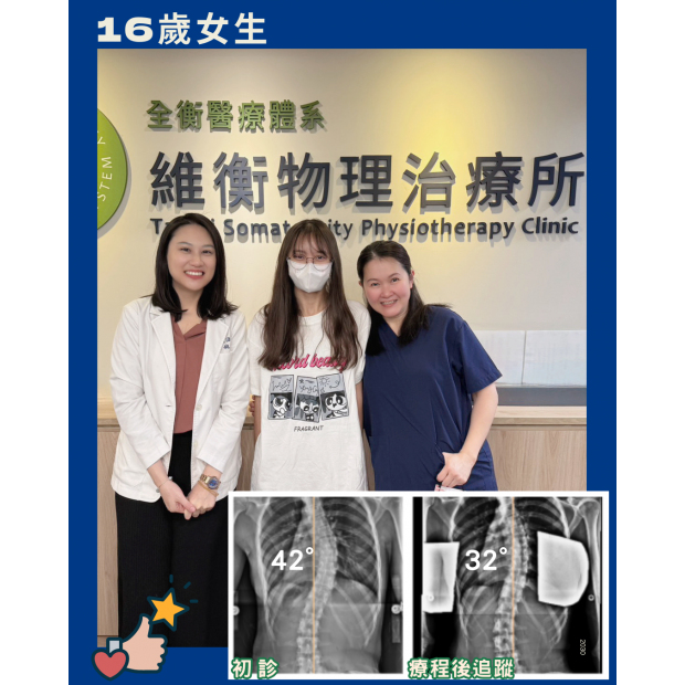 16歲女生胸椎側彎由42度改善至32度