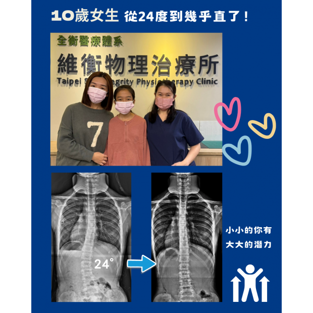 衡觀診所 脊椎側彎矯正 案例分享.png