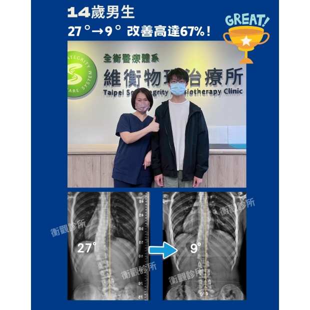 衡觀診所 14歲側彎男生 矯正案例07761.png