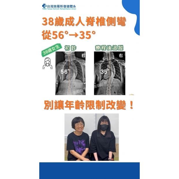 38歲成人脊椎側彎改善實證：56° → 35°：別讓年齡限制改變-封面7788.jpg