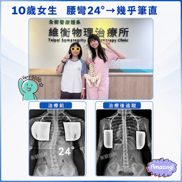 6130 側彎矯正案例分享.png