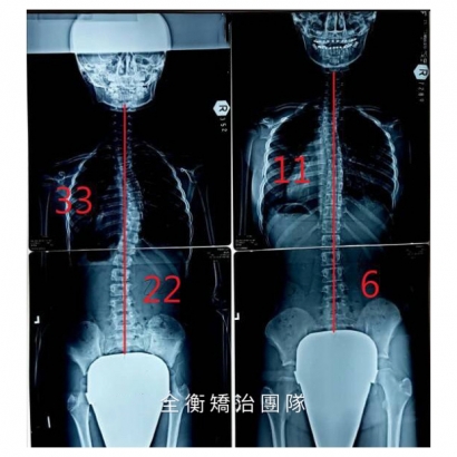 案例5：X光 上傳官網.jpg