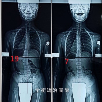 案例7 X光對比 上傳官網.jpg