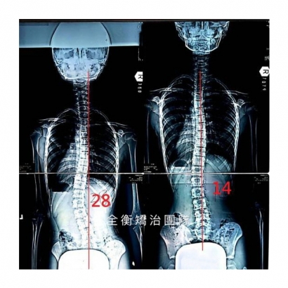 案例8 X光對比 上傳官網.jpg