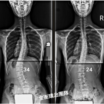 X光對比.jpg