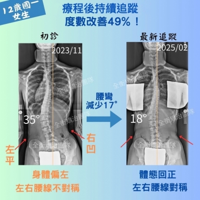 7294 X光對比.jpg