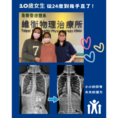 衡觀診所 脊椎側彎矯正 案例分享.png