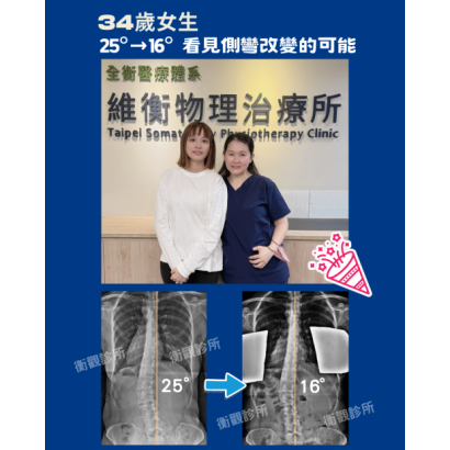 脊椎側彎矯正 案例分享.png