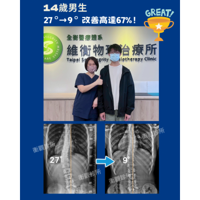 衡觀診所 14歲側彎男生 矯正案例07761.png