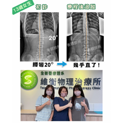 衡觀診所 13歲女孩 腰椎側彎矯正  案例分享.png