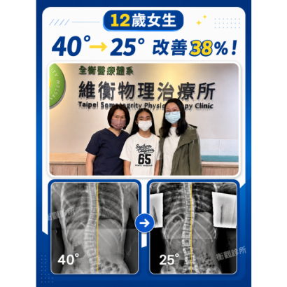 衡觀診所 12歲女生 8257側彎矯正案例分享.png 衡觀診所 12歲女生 8257側彎矯正案例分享.png