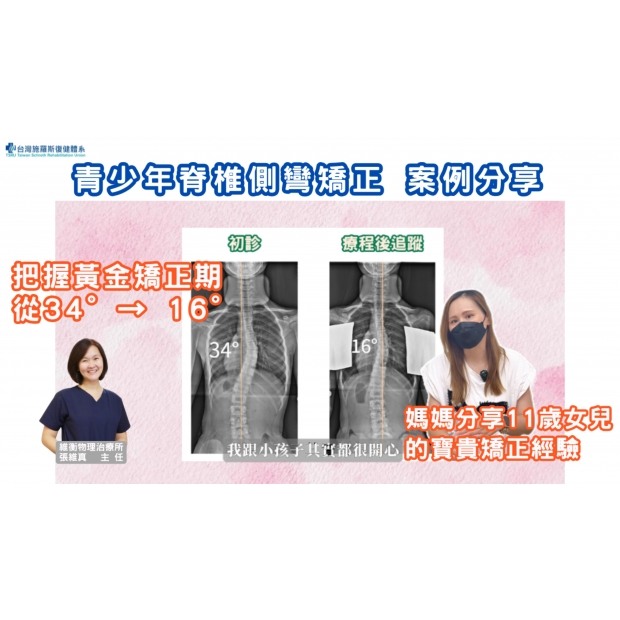 11歲女孩側彎矯正案例分享 34°→16°-封面.jpg