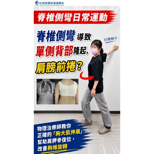 【脊椎側彎日常運動】側彎導致單側背部隆起，肩膀前捲？物理治療師教你正確的「胸大肌伸展」，幫-封面.jpg
